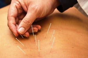 curso-de-acunpuntura-gratis-online-300x199